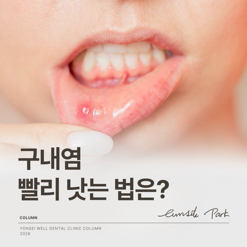 입안 하얀거 염증 헐었다면 구내염 낫는법