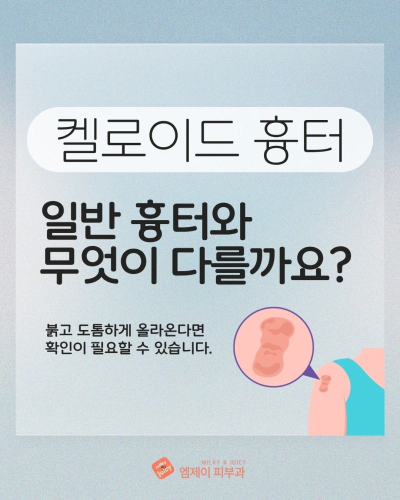 대전 켈로이드 흉터, 붉고 도톰하게 올라온다면 초기 확인이 중요할 수 있습니다