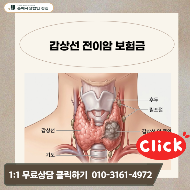  갑상선 전이암 보험금, 림프절 C77 코드 일반암 전액 받는 비법