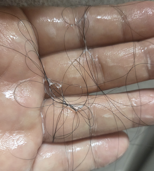 다이소 탈모샴푸 써봤는데 이거 진짜 괜찮은 거 맞아? 모제림 SOS 메가볼륨 솔직후기