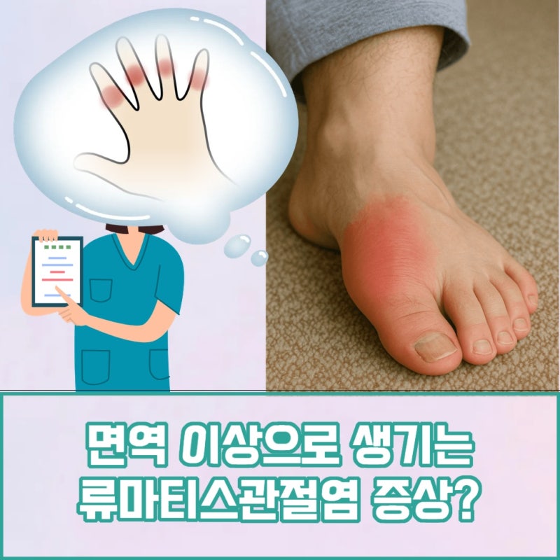 인천 옹진 류마티스 관절염 치료 방법 수술 없이 약물로 조절하는 이유