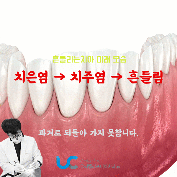 치주염 잇몸출혈 풍치증상 그 끝은 정해져있습니다