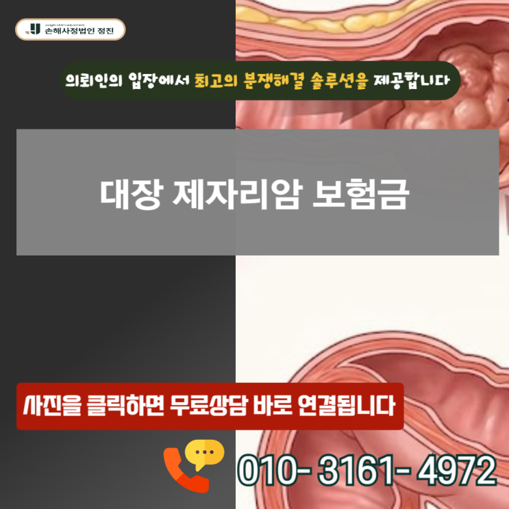  대장 제자리암 보험금, D01 코드에 숨겨진 일반암 진단비 수령의 비밀