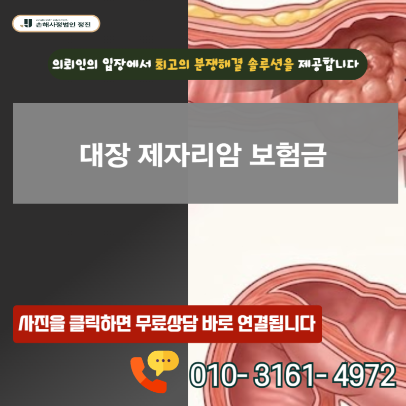 대장 제자리암 보험금, D01 코드에 숨겨진 일반암 진단비 수령의 비밀