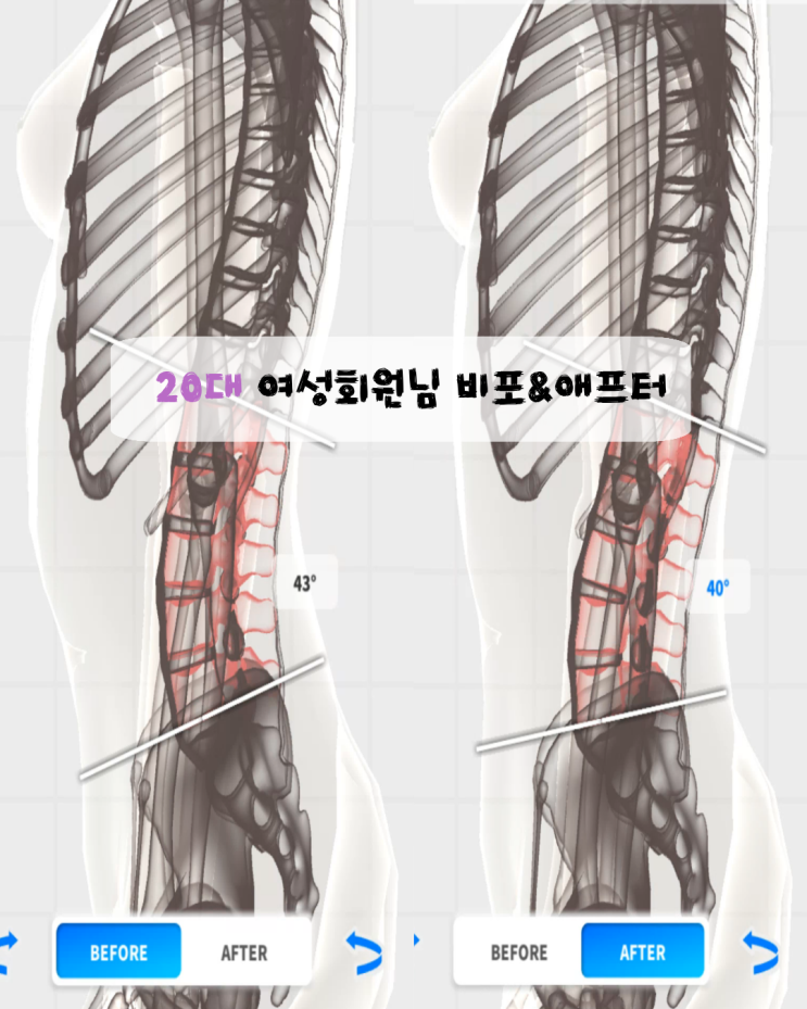  오산 세마역 필라테스 린                     20대 여성 회원님  체형 변화 후기