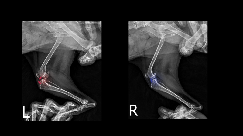 해당 환자의 x-ray 사진 (좌) 경골이 앞으로 밀린 것, (우) 이해하기 쉽게 십자인대를 묘사한 이미지