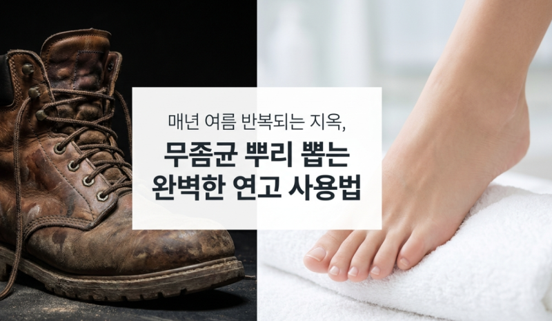 발 무좀 연고 가려움 멈췄다고 서랍에 넣으셨나요? 무좀균 뿌리 뽑는 3주 법칙