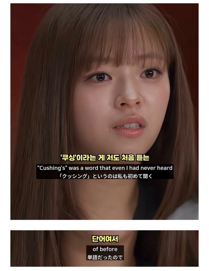 If Your Face Suddenly Swells and Bruises, Suspect This Symptom | Self-Diagnosis of Cushing's Syndrome, Overcome by TWICE's Jeongyeon