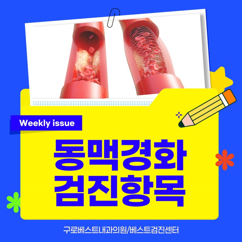 동맥경화 위험 체크하는 혈관 검사 방법! ABI 발목상완지수와 혈액 & 초음파검사