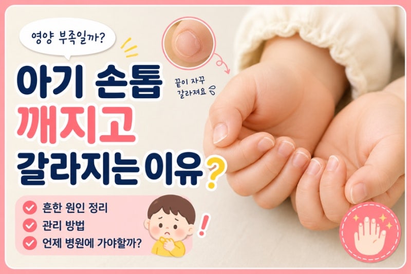 아기 손톱 깨지고 갈라지는 이유, 영양 부족일까?