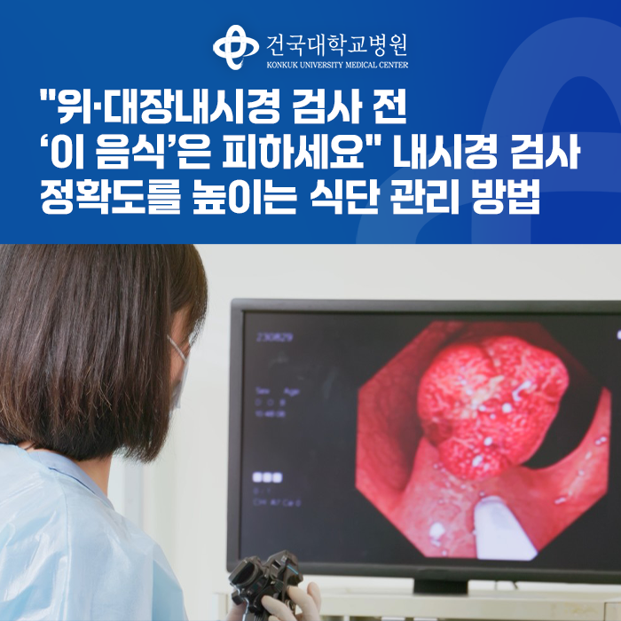 "위·대장내시경 검사 전 ‘이 음식’은 피하세요" 내시경 검사 정확도를 높이는 식단 관리 ....