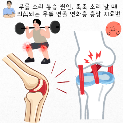 무릎 소리 통증 원인, 뚝뚝 소리 날 때 의심되는 무릎 연골 연화증 증상 치료법