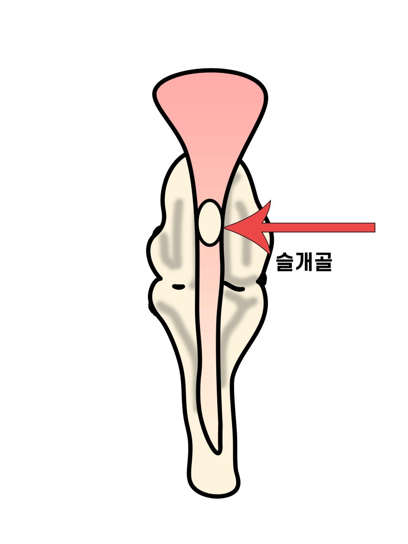 (좌) 정상적인 슬개골, (우) 슬개골 탈구
