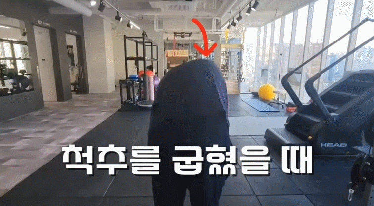 대구척추측만증, 운동으로 좋아질 수 있나요?