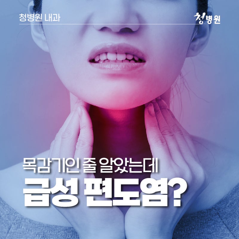 목감기인 줄 알았는데 급성 편도염? 증상과 치료가 필요한 경우