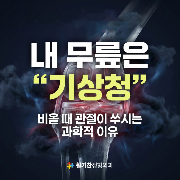  내 무릎이 기상청? 비 올 때 관절이 아픈 과학적 이유