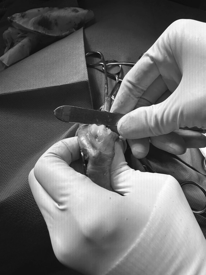 해당 환자의 수술 사진(활차구성형술/TPLO/지대중첩술)