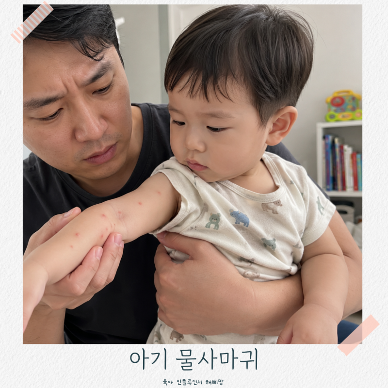 아기 물사마귀 원인 증상 연고 유아 소아 관리방법