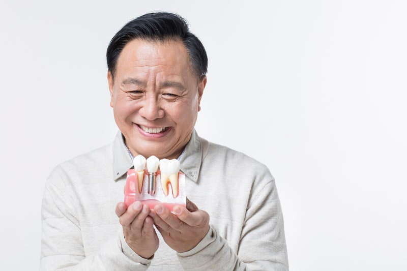 풀아치 임플란트 비용, 왜 환자마다 차이가 생길까요?