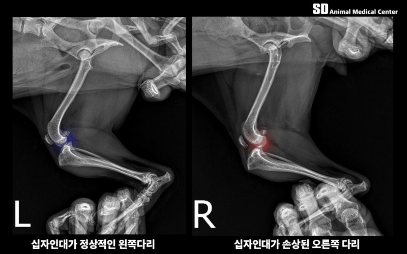 십자인대가 제대로 역할을 못하는 이미지 (다른 환자)