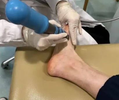 족저근막염 주사,치료방법 총정리이것까지 알아야 나아요