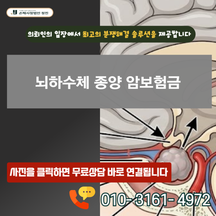  뇌하수체 종양 암보험금 거절 통보를 받으셨나요? D35.2 코드로 암 진단비 받아낸 실전 보상 가이드