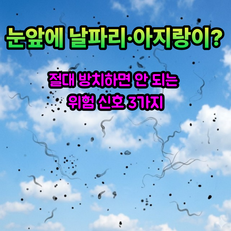 눈에 검은 점 아지랑이 비문증 증상 원인, 망막박리 위험 신호와 산동 검사 비용 주의 사항