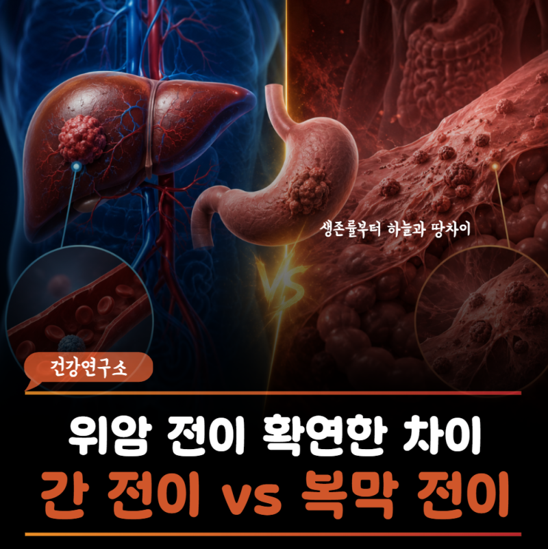 위암 "간전이 vs 복막전이" 같은 위암4기인데 왜 이렇게 다른 건가요