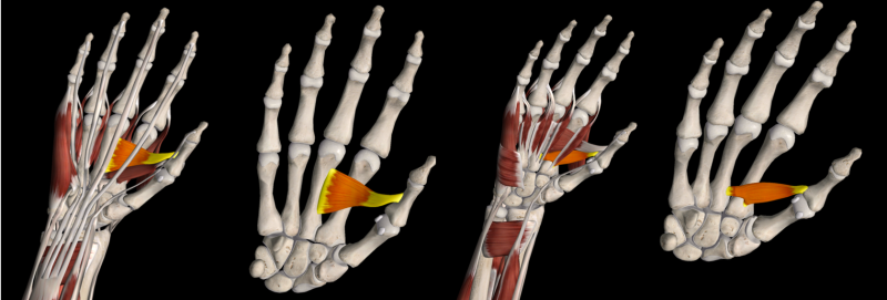 스마트폰 많이 쓰는 사람들의 손 통증 : 무지내전근 / 엄지모음근 / Adductor pollicis 임상근육해....