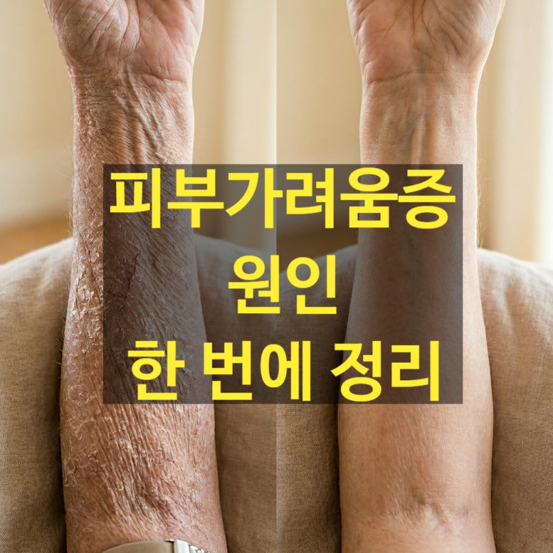 노인피부가려움증 원인 치료법 한 번에 정리