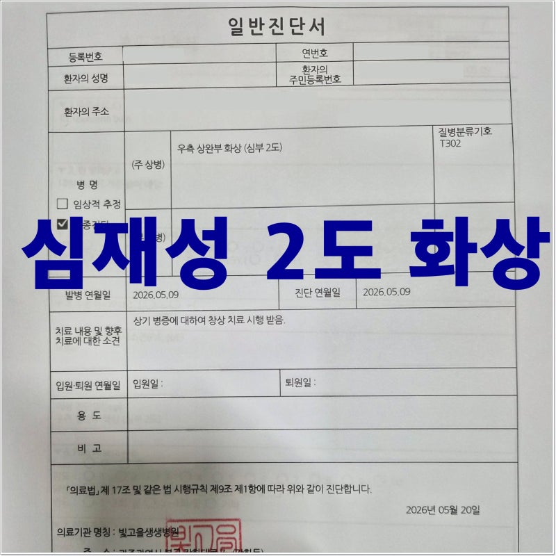 화상진단비 보험청구사례 - 뜨거운 물에 화상을 입어서 심재성2도(심부2도)진단이 나와서 진....