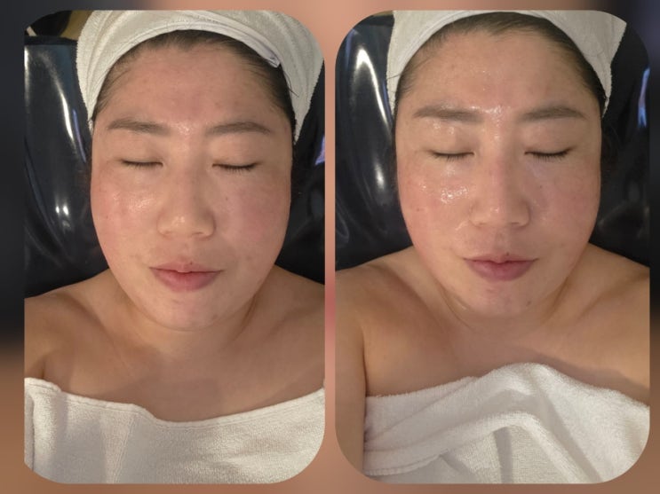  [김해삼계동]피부광채 제대로 살린 탕후루관리 김해에스테틱 '빈스뷰티'