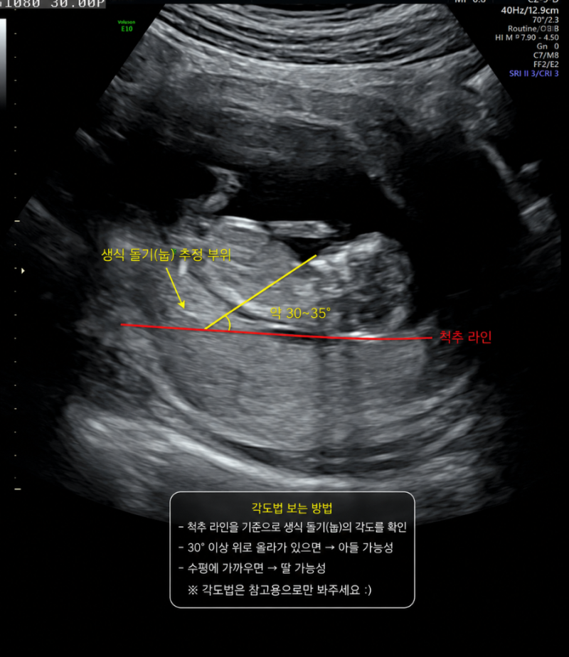 12주 성별 장꾸맘 각도법 보는법 및 정확도 후기 (+베이비빌리 어플)