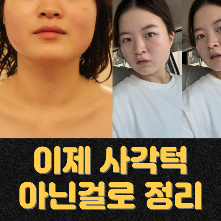  천안 신부동 윤곽관리, 사각턱관리 전 얼굴부종부터 봐야 할까?