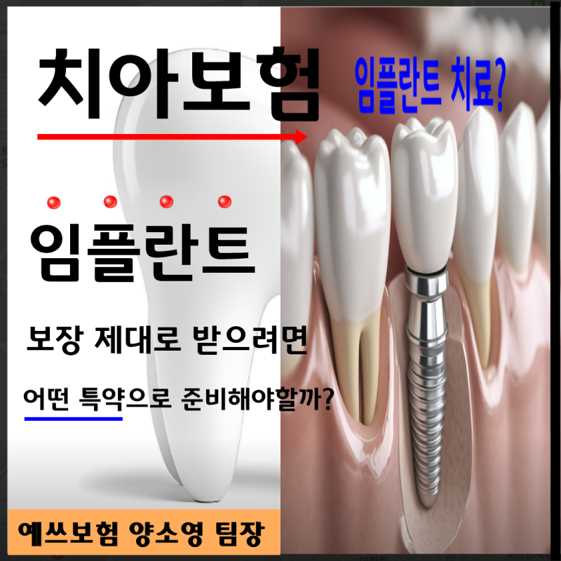 [50대 치아보험 가격] 임플란트 준비될 때까지 노력하는 13년차 전문가입니다.