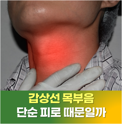 [사당 갑상선 검사] 갑상선목부음, 단순 피로 때문일까