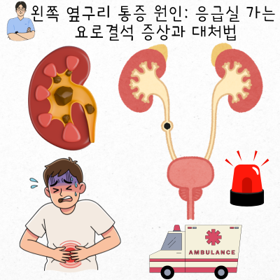 왼쪽 옆구리 통증 원인: 응급실 가는 요로결석 증상과 대처법
