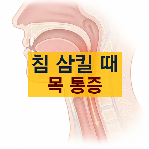 침삼킬때 목통증 원인과 약국 약, 갑상선 연관성, 오른쪽 왼쪽 차이