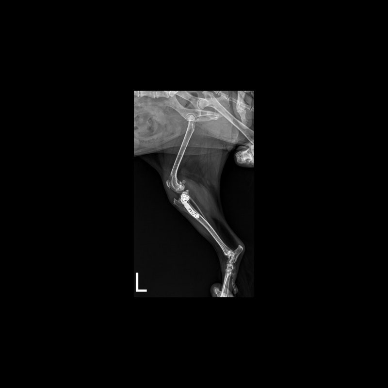 해당 환자의 수술 6주 차, x-ray 사진