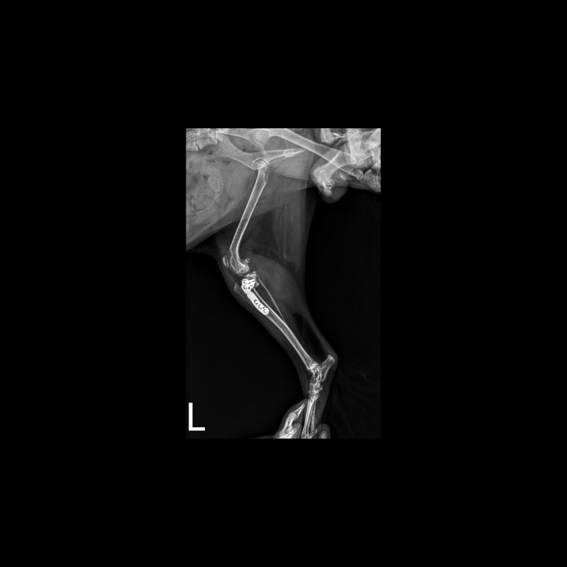 해당 환자의 수술 11일차, x-ray 사진