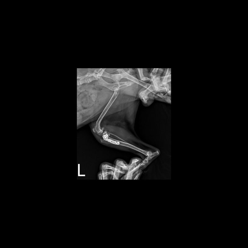 해당 환자의 수술 11일차, x-ray 사진
