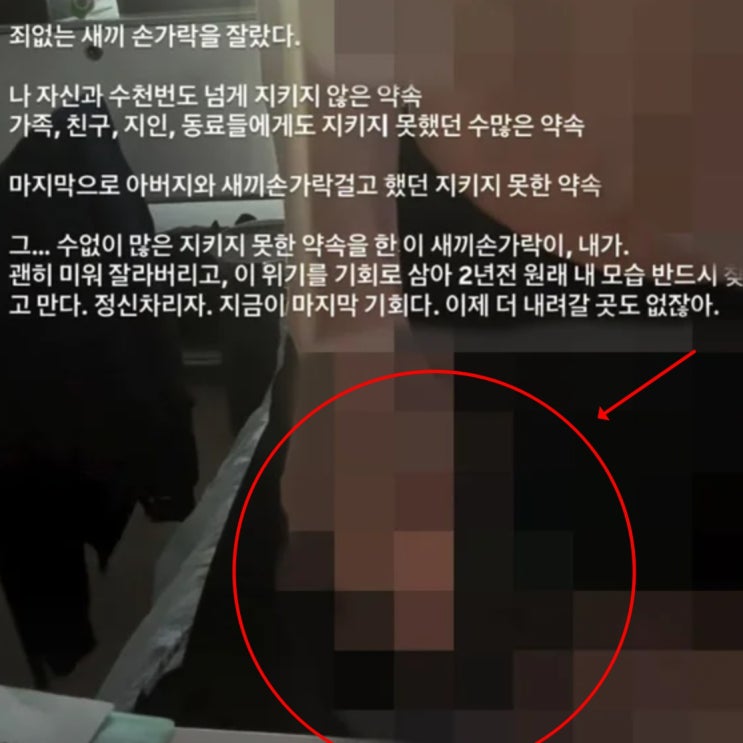 <b>장동주</b> 인스타 보니, “손가락 절단 왜?” 배우도 은퇴한다는데