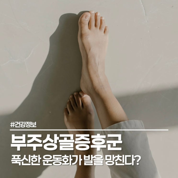  부주상골증후군 기능성 깔창이 정답인 이유