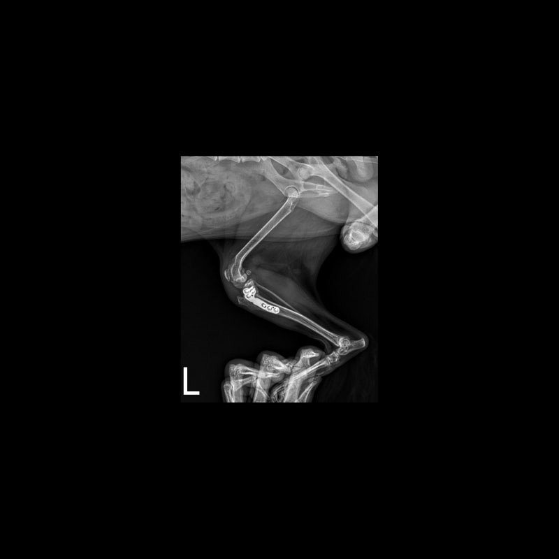 해당 환자의 수술 6주 차, x-ray 사진