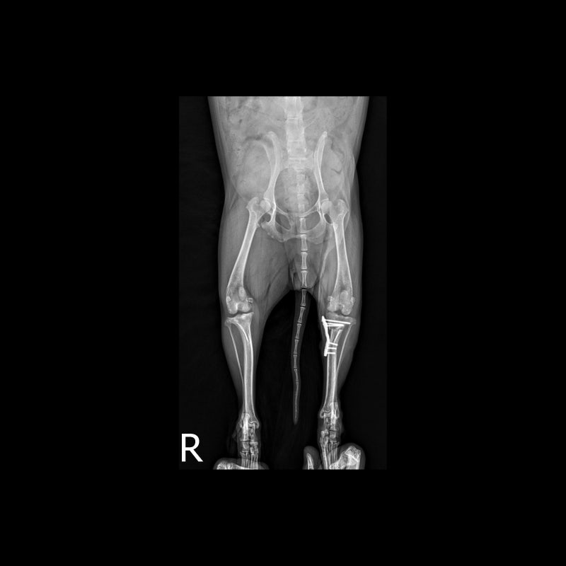 해당 환자의 수술 11일차, x-ray 사진