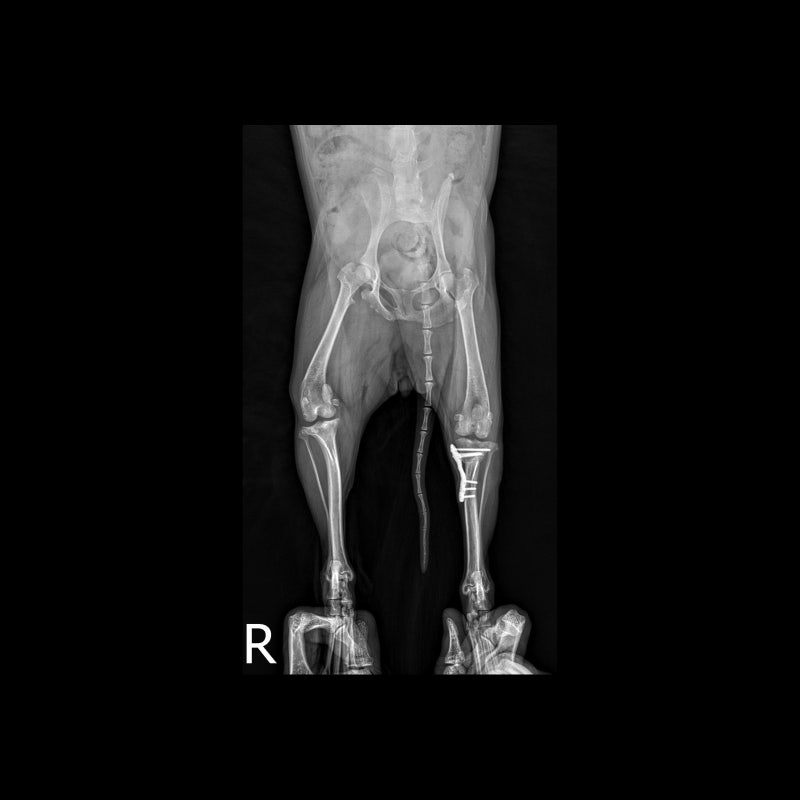 해당 환자의 수술 6주 차, x-ray 사진