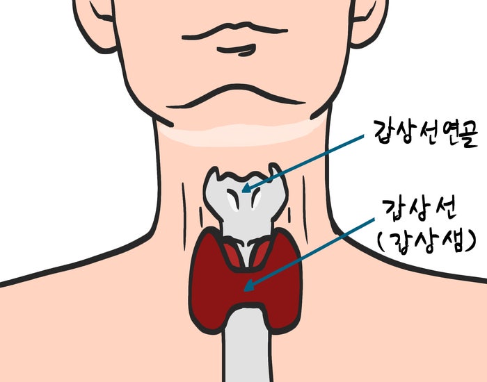 [갑상선암 수술 후 3~5년] 완치 이후가 더 중요합니다.