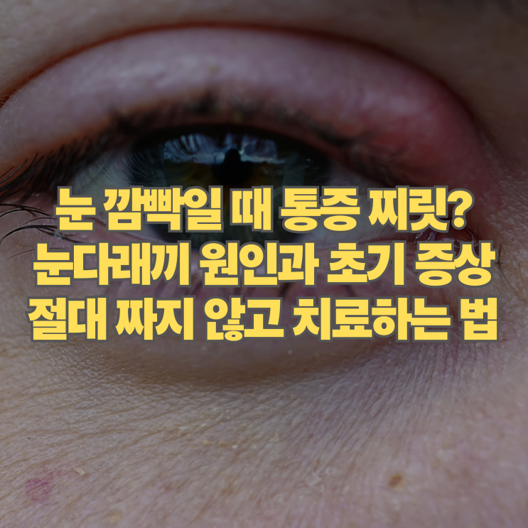  눈 깜빡일 때 찌릿? 눈다래끼 원인 초기 증상과 치료