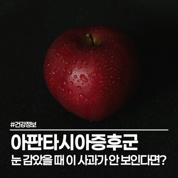  아판타시아증후군 테스트, 사과를 상상하면 까만 화면만 보이시나요?