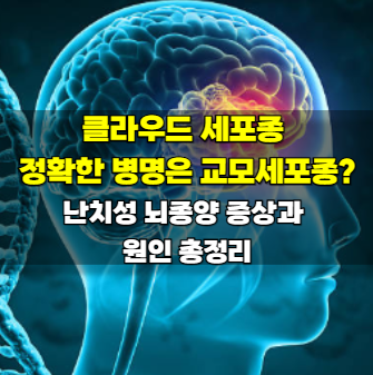 클라우드 세포종 정확한 병명은 교모세포종? 난치성 뇌종양 증상과 원인 총정리